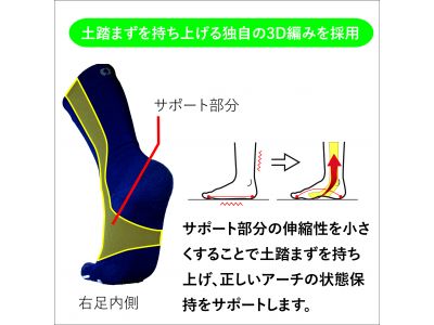 アーチサポート